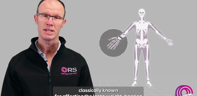 Image for World Physiotherapy Day With ORS